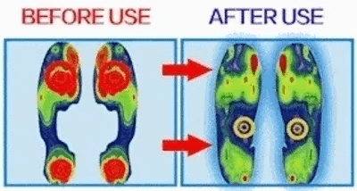 🔥Best Seller-Last Day Sale 50% OFF🔥Women's floral platform wedge sandals